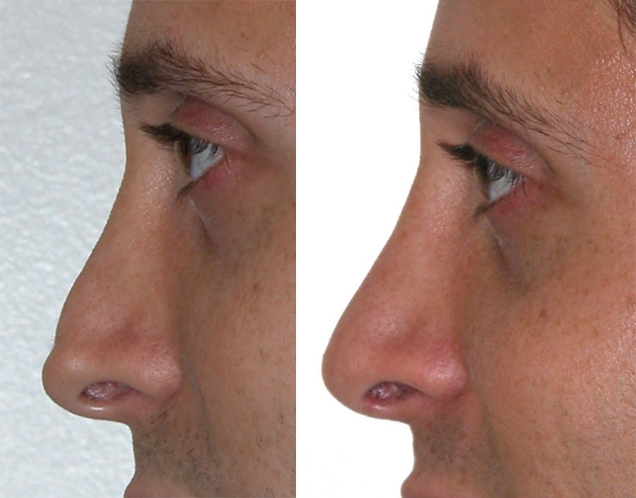 real patient before and after image