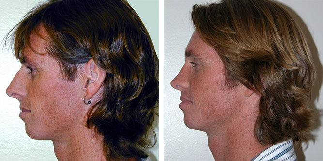 real patient before and after image
