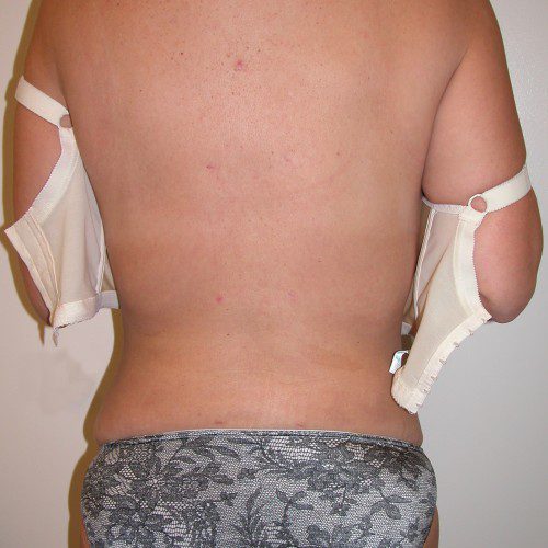 real patient after image