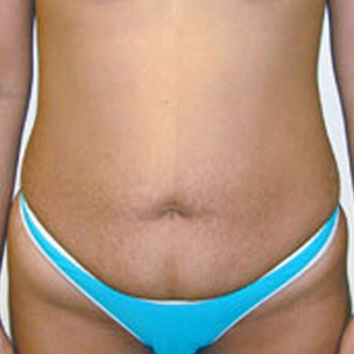 real patient before image