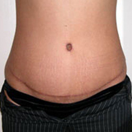 real patient after image