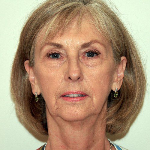 real patient before image