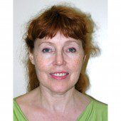 California Facelift 112