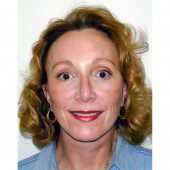 California Facelift 74