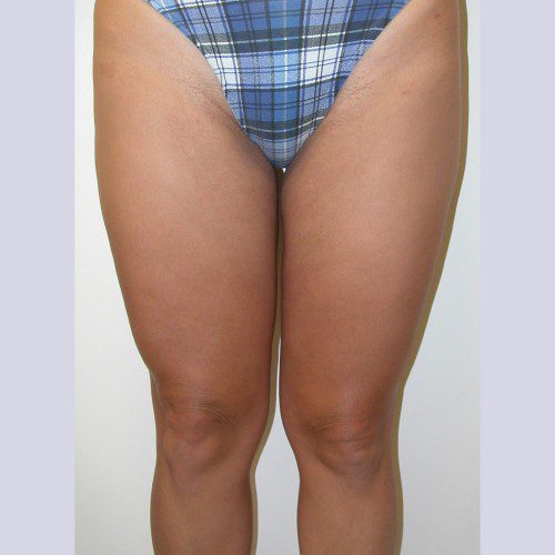 real patient after image