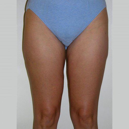 real patient after image