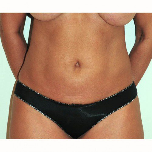 real patient before image