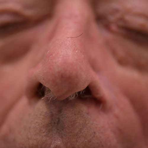 real patient after image