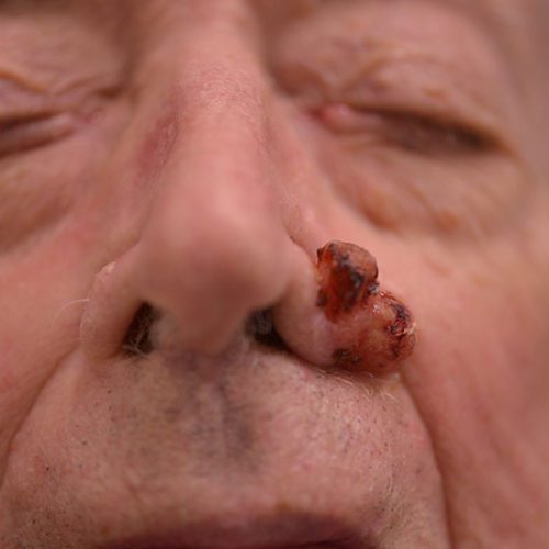 real patient before image