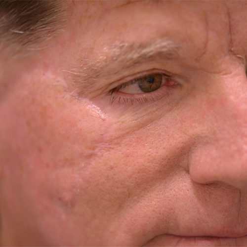 real patient after image