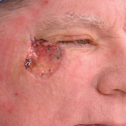 real patient before image