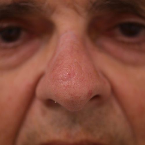 real patient after image