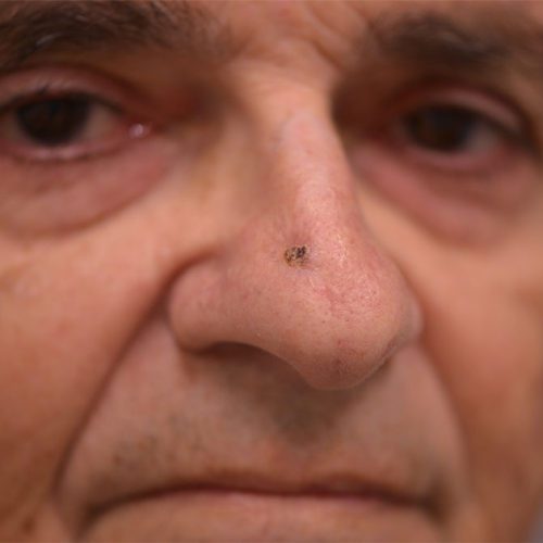 real patient before image