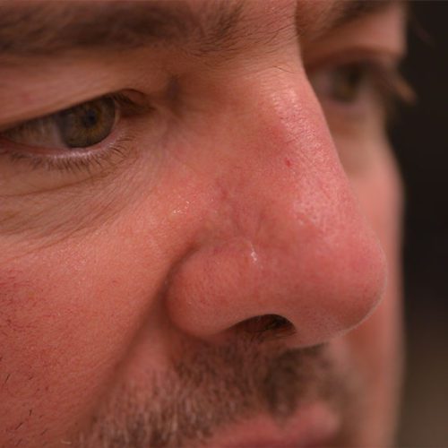 real patient after image