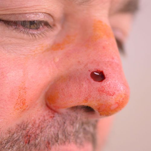 real patient before image