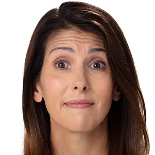 Case--5748 | Before BOTOX® Cosmetic 2