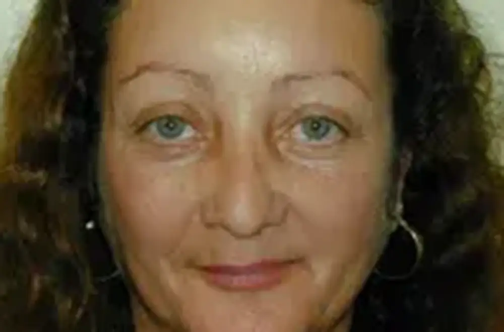 Blepharoplasty--4465 | After Face