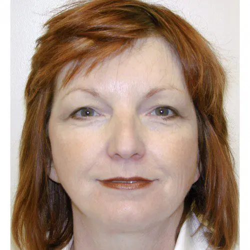 Case--3471 | Before Peels & Fillers 1