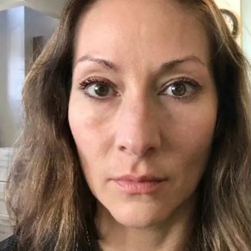 Case--2828 | After BOTOX / Injectable Fillers 1