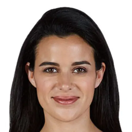 Case--3204 | After Injectable Fillers 1