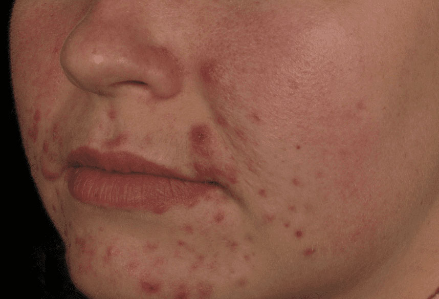 Case--6405 | Before Skin Care 1